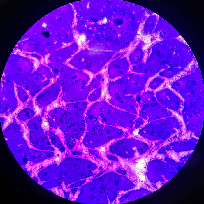 No More Repression EP inc. Remixes by Mordio & Mind Static