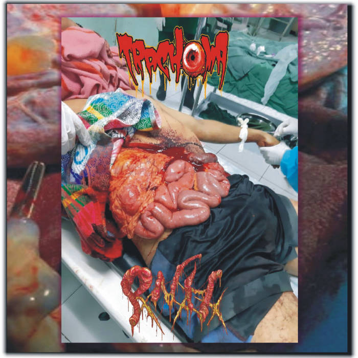 Tracks from split with PxNxHx