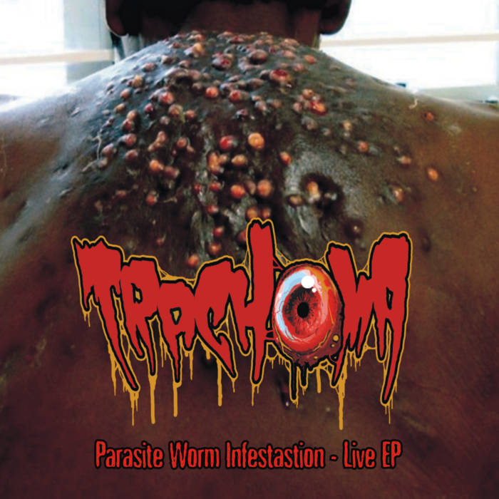 Parasite Worm Infestation - (Gore)Alive Ep