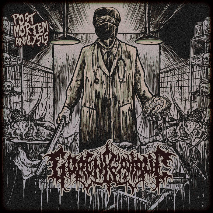 Post-Mortem Analysis