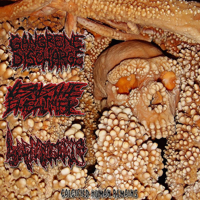 Calcified Human Remains w/ Gangrene Discharge Jesus The Embalmer