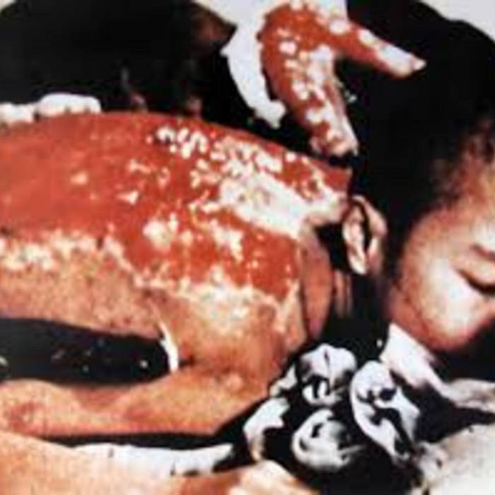 Radiation sickness (Repulsion cover)