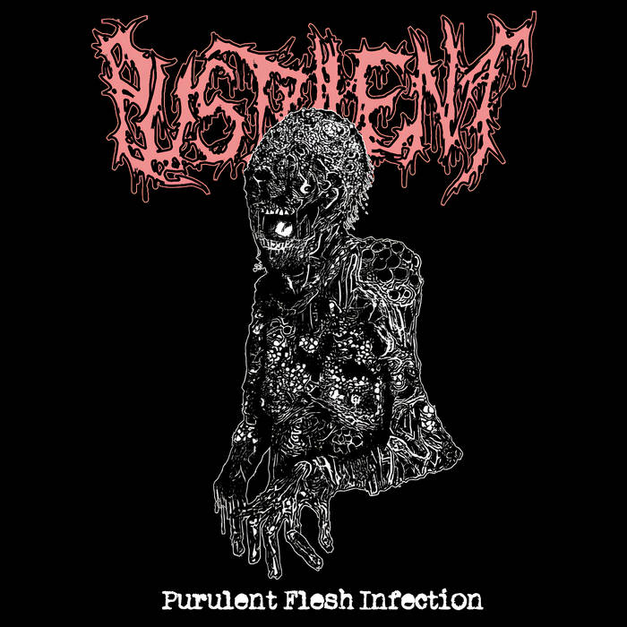 Purulent Flesh Infection