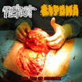 The Art of Surgery (split with Lipoma)