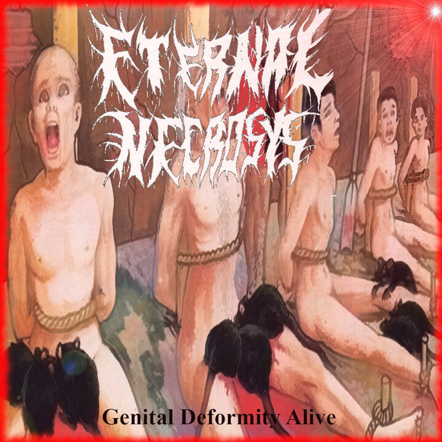 Genital Deformity Alive