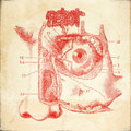 Amblyopia