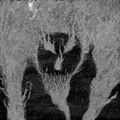 Vayu/Tahazu Split
