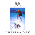 SSRI Brain Zaps